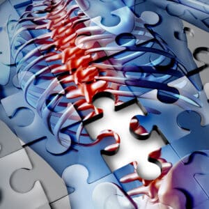 Spinal Cord Injuries Spinal Cord Injury
