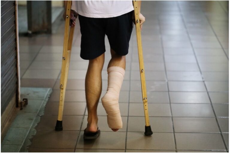 Suffered Broken Bones from an Auto Accident? Take these Next Steps