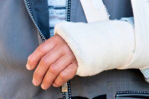 The Impact of Broken Bones Short-Term Pain, Long-Term Challenges