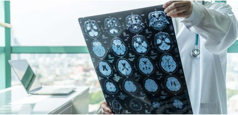 A doctor holding up a sheet of brain scan images